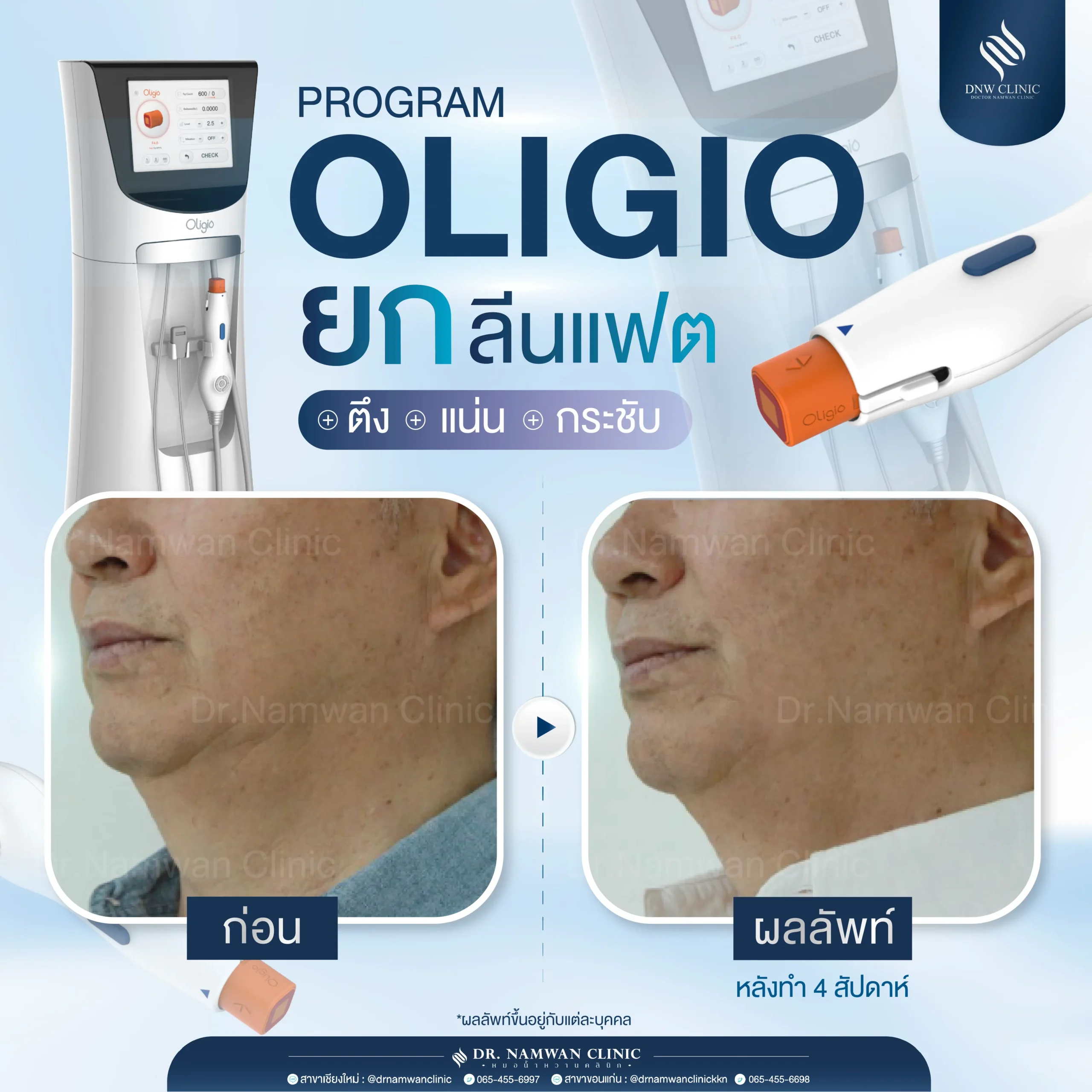 รีวิว Oligio-02
