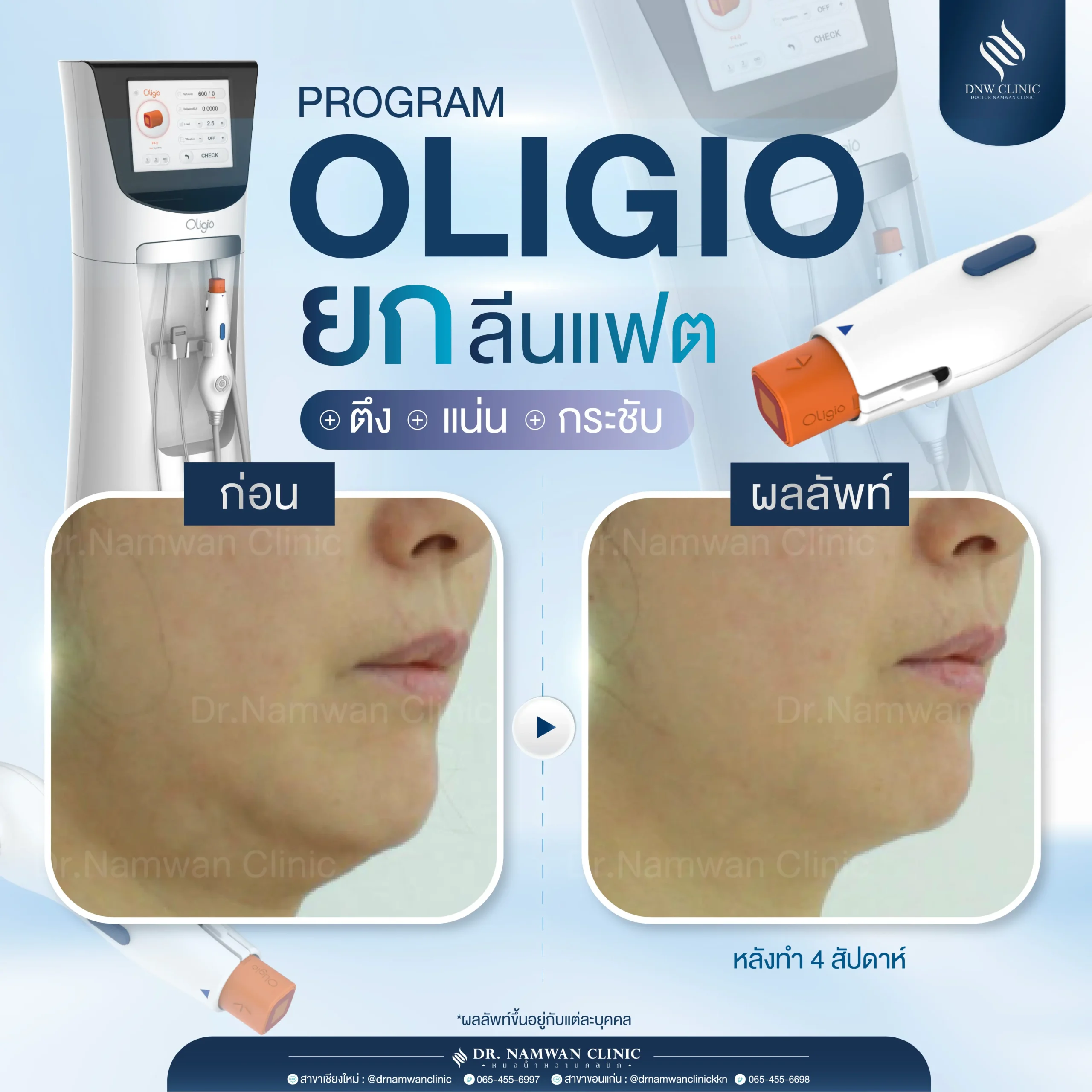 รีวิว Oligio-03