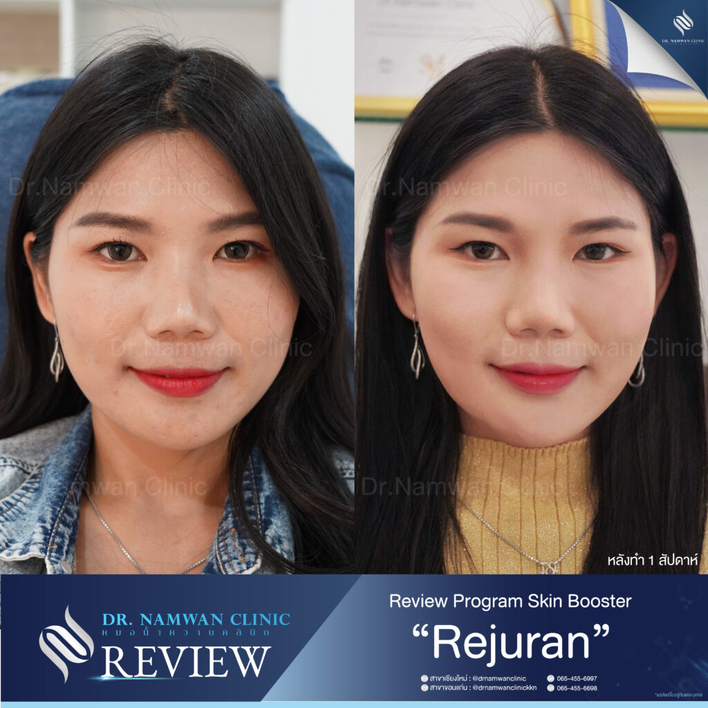 รีวิว+กรอบหลัก 8
