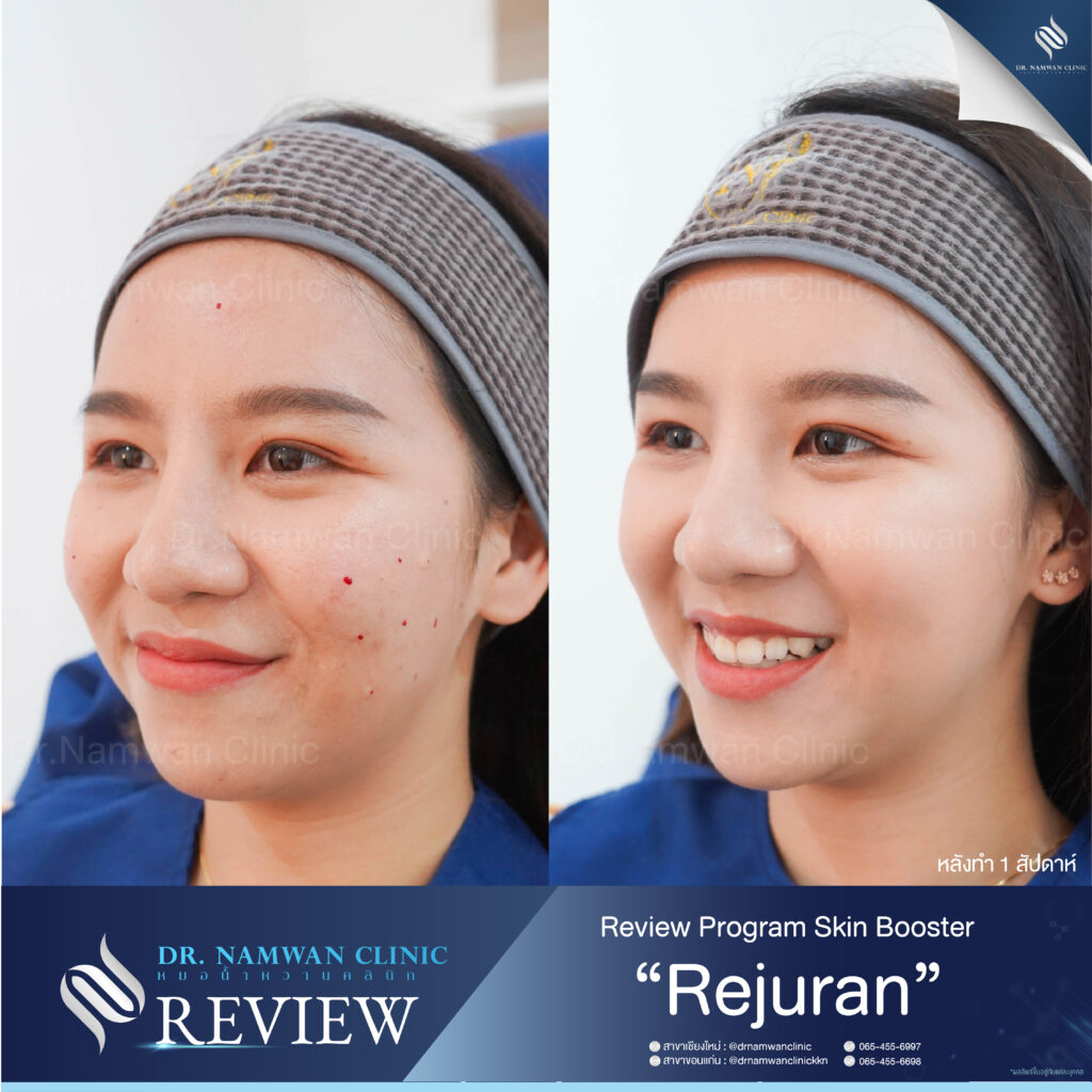 รีวิว+กรอบหลัก 8+